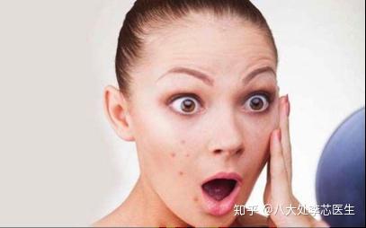 鼻头长痘真相揭秘，成因、治疗与预防全攻略