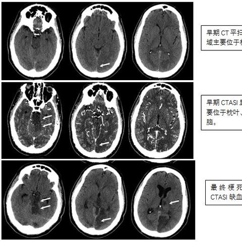 全球脑血管领域顶尖研究机构与专家深度解析，排名前十一览